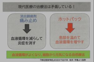 痛み止め　どっちを使いますか？